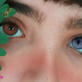 fakta heterochromia kelainan pada mata